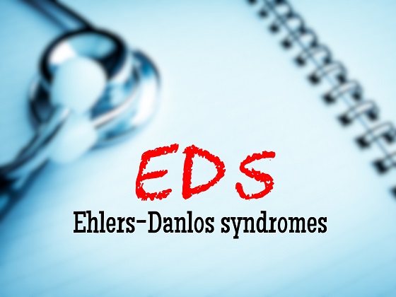 Sindrom Ehlers Danlos