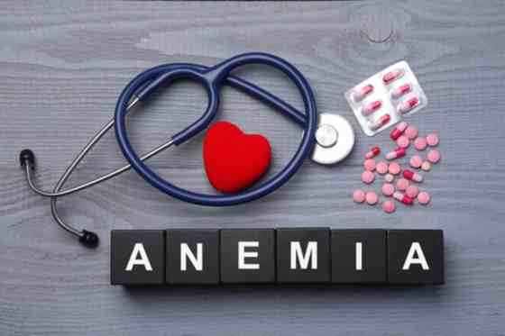 Anemia microcitara este o afectiune grava? Cauze, simptome, tratament