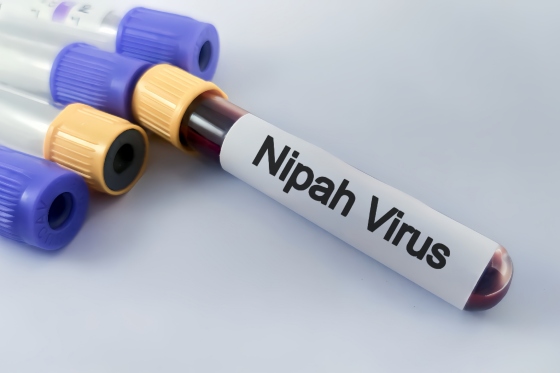 Virus Nipah - origine, transmitere, simptome si tratament