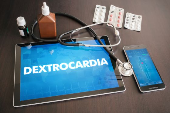 Dextrocardie – ce este, simptome, cauze si diagnostic