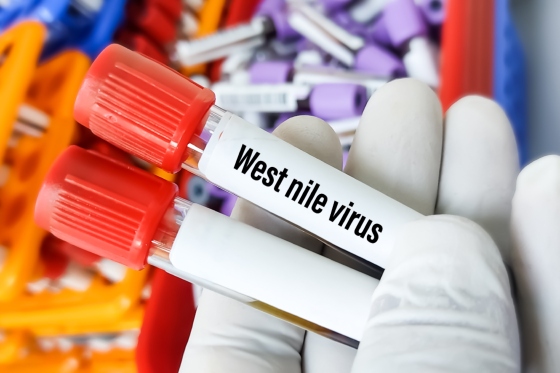 Infectia cu virusul West Nile: cauze, transmitere, simptome