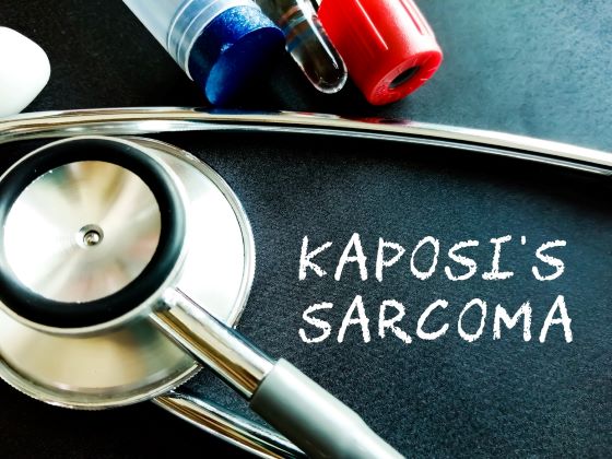 Sarcom Kaposi: ce este, ce cauze are si care sunt optiunile de tratament