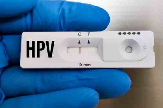 Test HPV, tot ce trebuie sa stiti