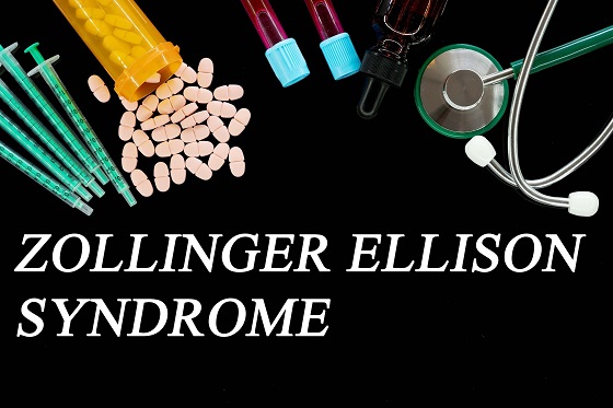 Sindromul Zollinger-Ellison: simptome, diagnostic si tratament