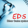 Sindrom Ehlers Danlos