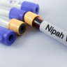 Virus Nipah - origine, transmitere, simptome si tratament