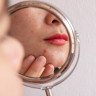 Cum sa evitati acneea cauzata de cosmetice