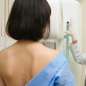 Ce trebuie sa stiti despre mamografie, un test important pentru screening-ul cancerului de san
