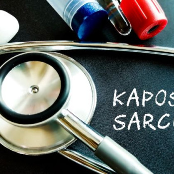 Sarcom Kaposi: ce este, ce cauze are si care sunt optiunile de tratament