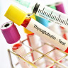 Tiroglobulina: ce este si care este rolul sau in functionarea tiroidiei