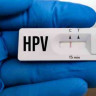 Test HPV, tot ce trebuie sa stiti