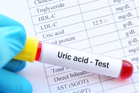 acid-uric-crescut-diagnostic