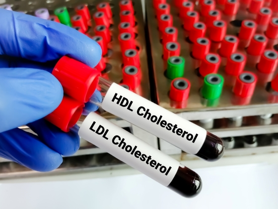 colesterol-valori-test