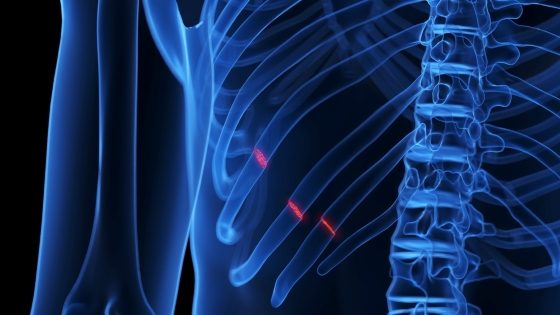 diagnostic-radiografie