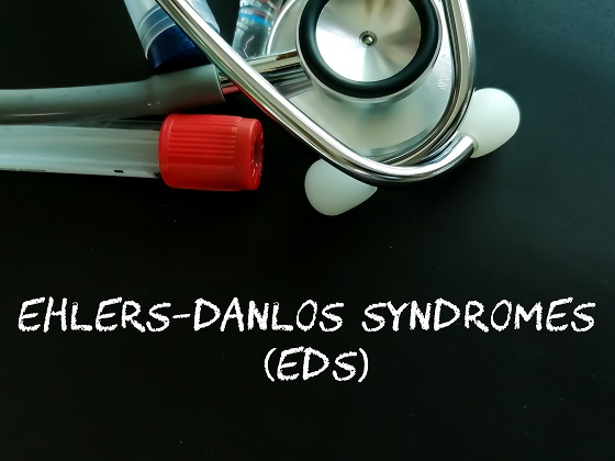 Sindrom-Ehlers-Danlos