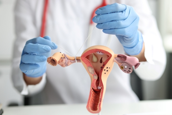 cauze-trompe-uterine-infundate