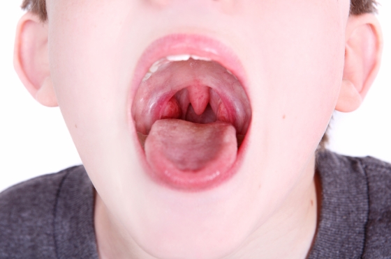 ce-este-uvula