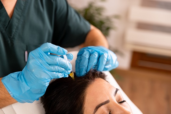 tratament-PRP-pentru-scalp